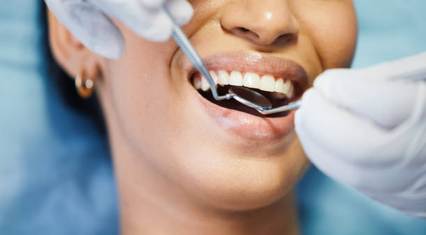 Best Emergency Dental Care for Broken or Chipped Teeth in Nokomis, IL